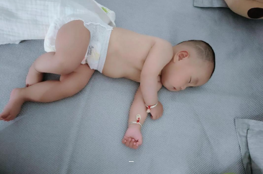 甘孜宝宝脸上有白色斑块